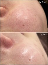 ヒルナム(Heal Nam)/プロセルセラピーズ~フェイス~