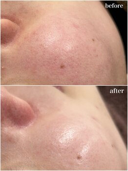 ヒルナム(Heal Nam)/プロセルセラピーズ~フェイス~