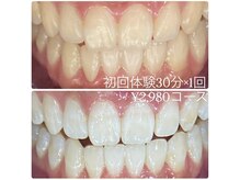 ホワイトニングルーム 横浜店(Whitening Room)/セルフホワイトニング/横浜