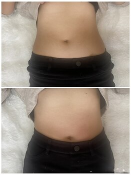 ソレラ(sorelle)/腸もみ★美腸ケア/くびれ作り♪