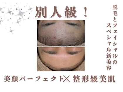 エステティック レイビス 銀座店(RAYVIS)の写真