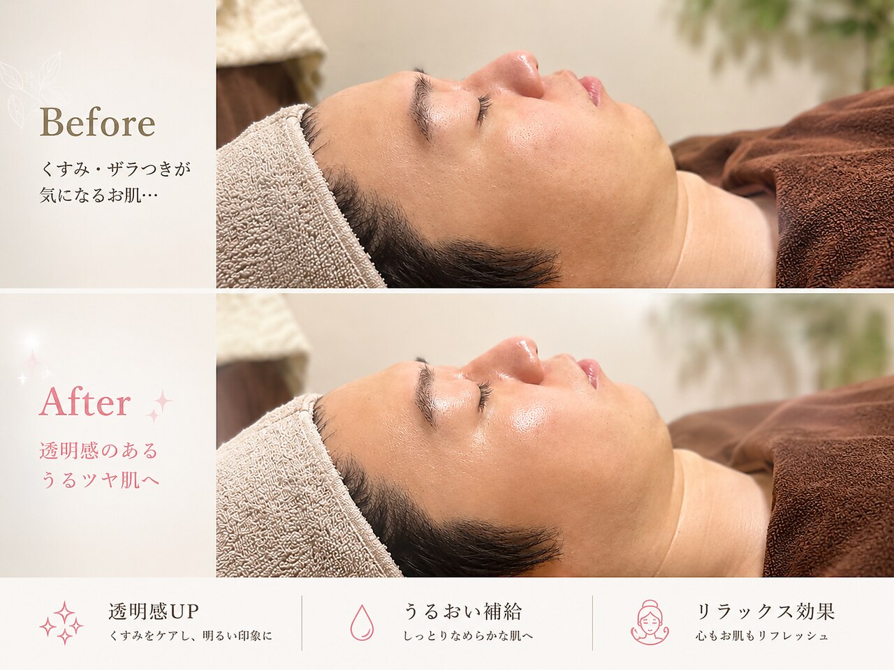 世田谷区で毛穴ケアが人気のエステサロン｜ホットペッパービューティー