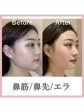 ラプリ 広島八丁堀店(Raplit) メンズも 大歓迎!