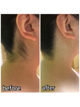 パーソナルエステティックサロン リボーン(ReBorn)/