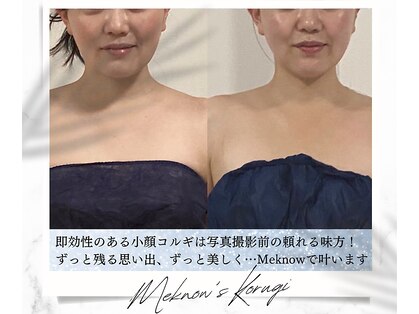 メノウ(Meknow)の写真