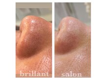 ブレリアントサロン 池袋店(brillant salon)の雰囲気（フォトギャラリーにBefore⇒After多数掲載中◎）