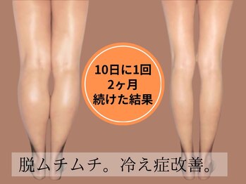 ローリエ/我慢しないダイエット