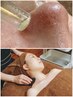 【毛穴/小顔/リフトUP】いちごっ鼻解消&かっさで凝り浮腫解消 