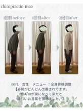 カイロプラクティック ニコ(nico)/ビフォー、アフター