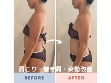 肩こり、巻き肩、姿勢まで改善