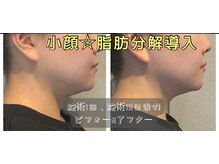リエート(LIETO)