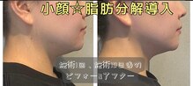リエート(LIETO)