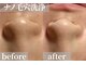 VS28スキンケアスタジオ バリイン 二子玉川(BALI IN)の写真