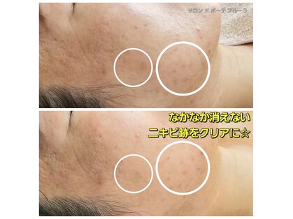 サロン ド ボーテ プルーラ(Salon de beaute PLURA)の写真