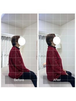 寿 天王寺院(KOTOBUKI)/天王寺/整体/肩こり/姿勢改善