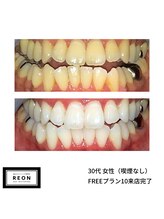 レオン 磐田(REON)/◇ お客様 before＆after ◇