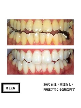 レオン 磐田(REON)/◇ お客様 before＆after ◇