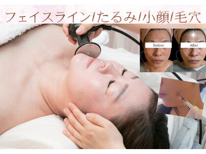 ティパニボーテ(Tipani Beaute')の写真