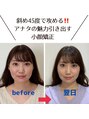 顔凛(カオリン)&nbsp;1回目からしっかり結果を出します。小顔矯正/小顔