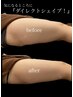 【春夏お得！痩身】気になる所を狙い撃ち！ダイレクトシェイプ9,350→5,200