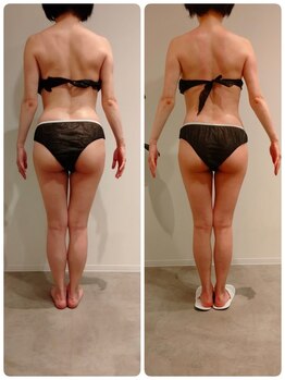 エイジングケアサロン 青山 本店/3種マシーン・90分最強痩身!