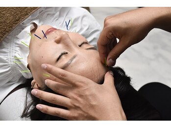 マゴコロ(MAGOKORO)の写真/【美容鍼メニュー有！】皮下組織に刺激して新陳代謝UP☆頬を引き上げる筋肉に働きかけ小顔＆リフトアップ◎
