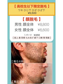 モット 神戸店(Motto)/全身脱毛