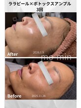 デトックスサロン モーミン/ララピール