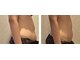 フォルチェ 己斐店(Folche)の写真