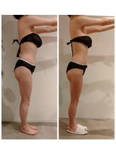 エイジングケアサロン 青山 本店/3種マシーン・90分最強痩身！