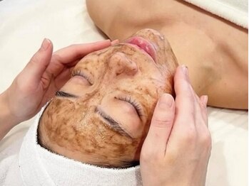 ラボーテヴェリテ(La Beaute Verite)の写真/【くすみ・肌荒れでお悩みの方に◎】肌負担が少なく剥離のないハーブピーリング★施術後すぐにメイクもOK♪