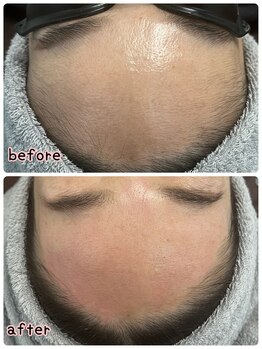 ケースタイル(k.style)/おでこの産毛まで綺麗