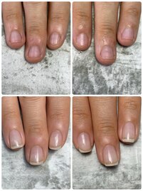 育成ビフォーアフター