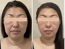 ドクターボディクリスタル(Dr.Body Crystal)/40代