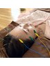 【ブライダル/特別な日に】電気美容鍼＋小顔調整90分