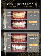 ホワイトニングプラス(Whitening+)/オフィス級ホワイトニング