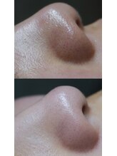 イル(iru.)/¥7,800