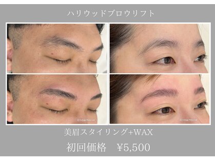 エピリス(EPILIS)の写真