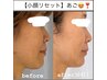 【小顔コース】小顔矯正×眠れるヘッドスパ×毛穴/全身と頭の骨格、顔のEMS