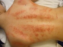 アジアン エステティック テラ(Asian esthetic TERRA)/【痩身／肩こり】カッサ★ボディ