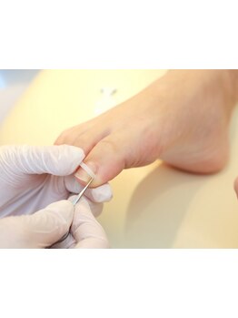 爪の悩みを解消できる（ケア含む）