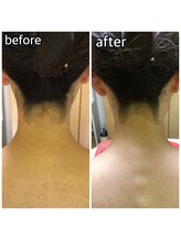 パーソナルエステティックサロン リボーン(ReBorn)/