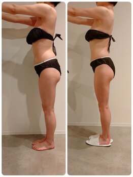 エイジングケアサロン 青山 本店/3種マシーン・90分最強痩身!