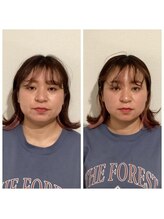 パンダ(Panda)/リフトアップ小顔矯正