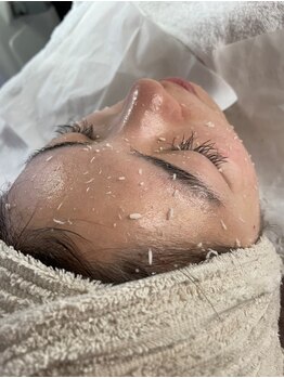 ルネ(Renee)/角質整理