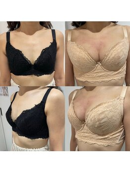 エスグレース 梅田店(S.grace)/ヘッドスパ痩身バストケアリンパ