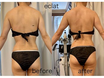 エクラ 五反田(eclat)/結果に自信あり