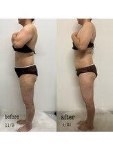 シャルム(Charme)/before・after