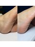 ［素足に自信を］ワンカラー＋角質ケア＊素敵な場所へ出かけたくなる季節に