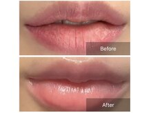 ホワイトニングサロンブライト 新宿店(Whitening salon bright)